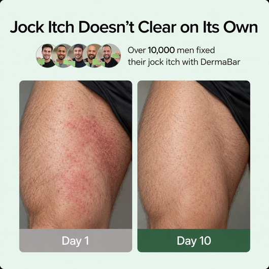 Tea Tree Oil Infused Cleansing Bar